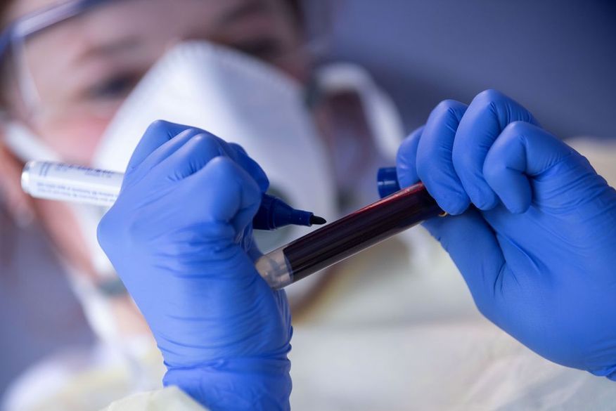 Paraíba não teve registro de óbitos por covid-19 nas últimas 24h