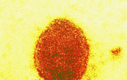 Henipavírus: novo vírus de origem animal infecta 35 pessoas na China, aponta estudo